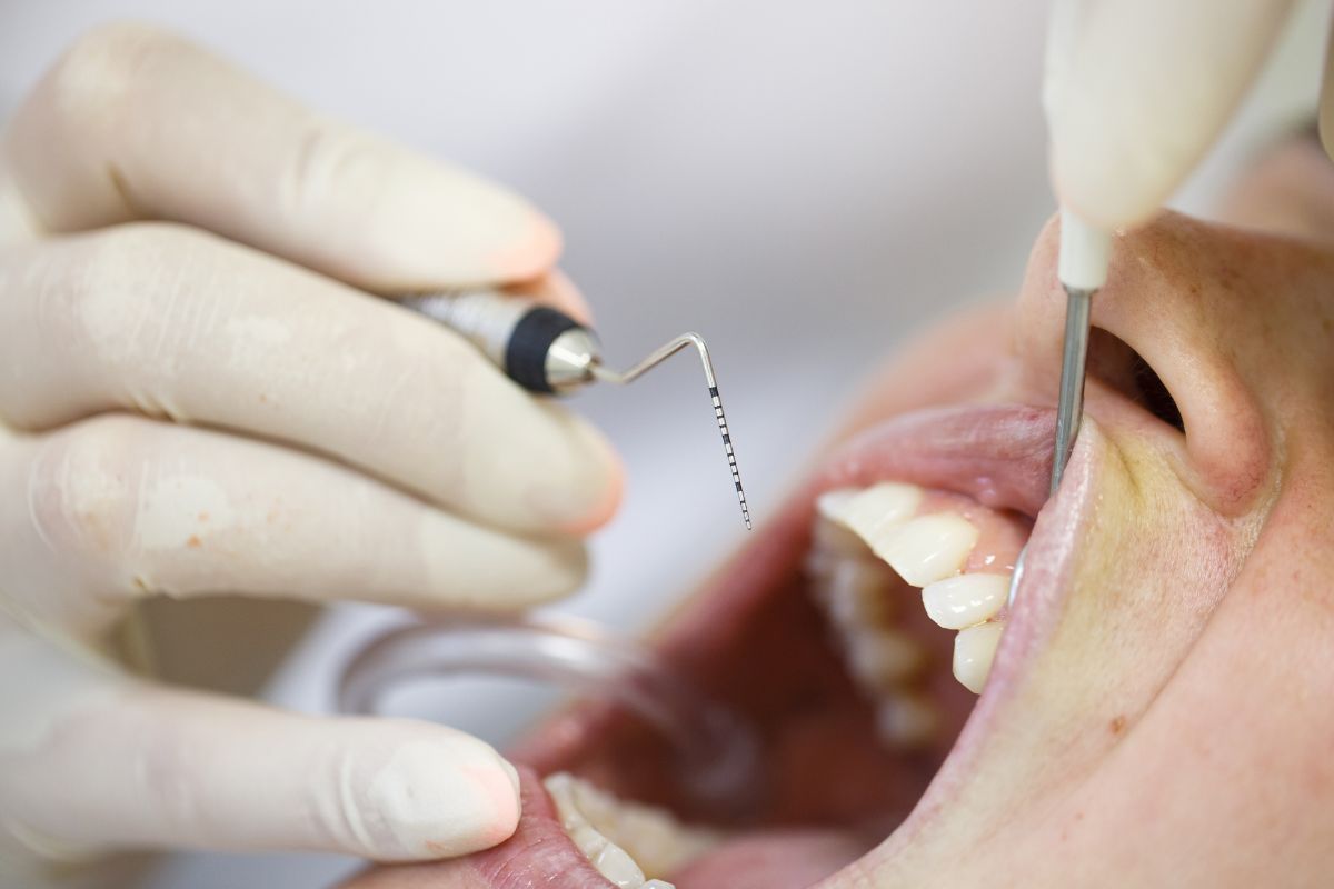 tratamiento periodontitis