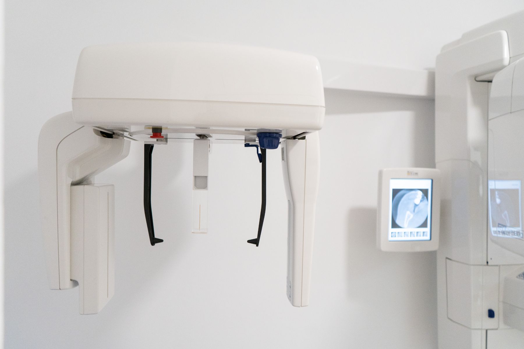 Radiografías extraorales