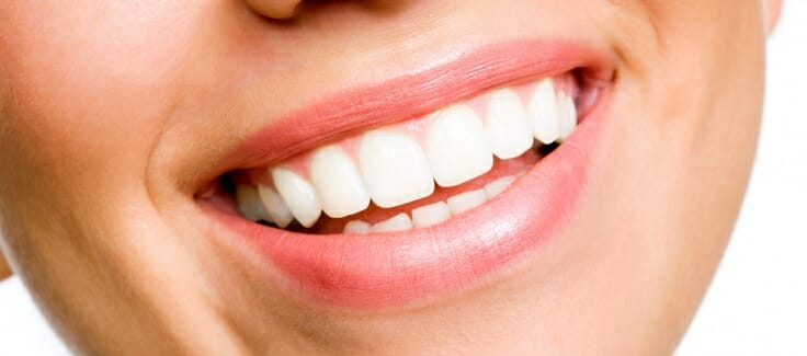 Tratamiento con carillas dentales. Tu nueva sonrisa en 15 días. - Clínica  Dental CIMER Paterna